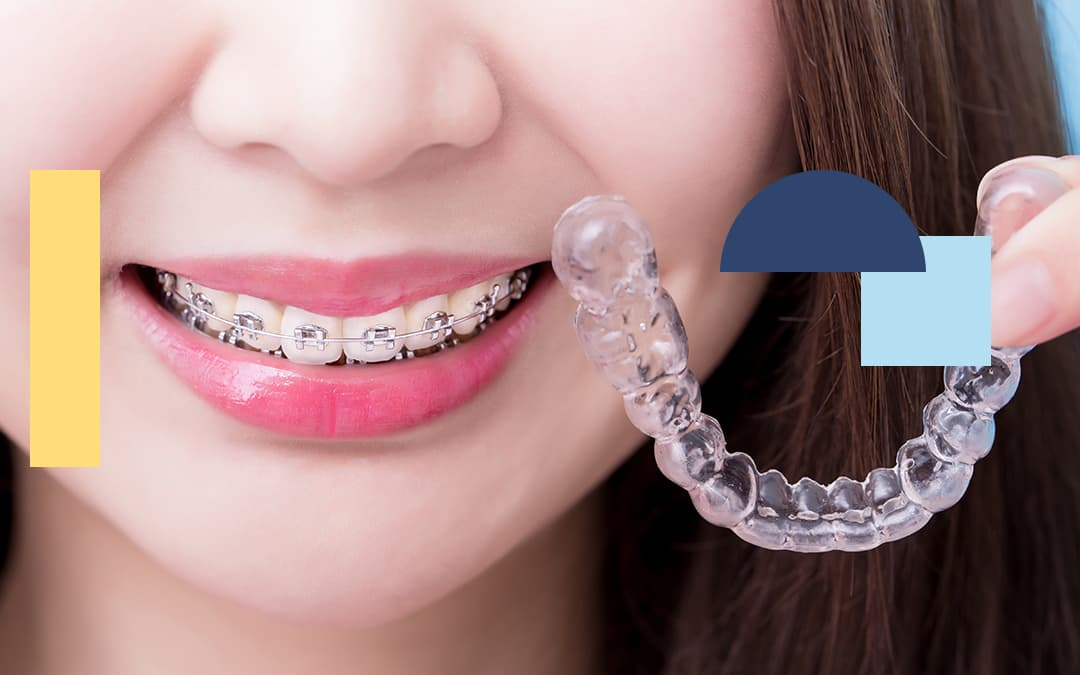 Orthodontics Orthodontics