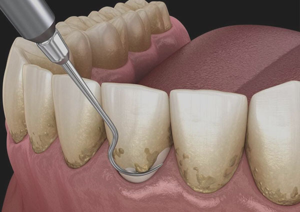 Periodontics
