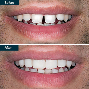 Cosmetic Dentistry